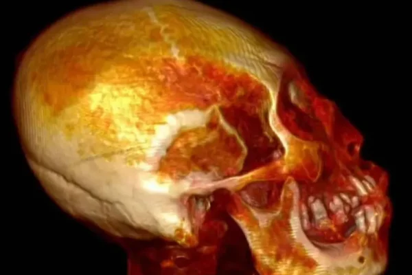 Análisis realizados a ‘momia alienígena’ de Jaime Maussan revelan algo inquietante